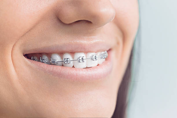 Best Traditional Braces  in Bald Kno, AR